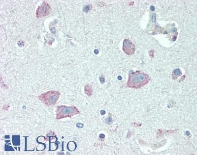 IHC-plus™ RGS4 Antibody