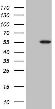 MSTN / GDF8 / Myostatin Antibody (aa24-266, clone OTI3A7)