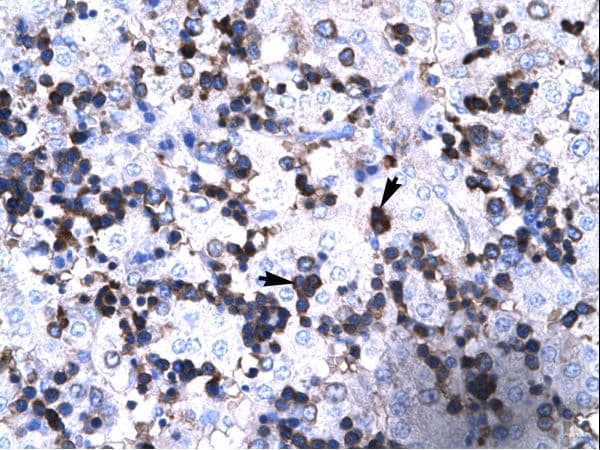 FOXP3 Antibody (aa100-149)