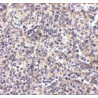 APG5 / ATG5 Antibody