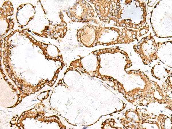 Polyclonal Rabbit anti-Human PDIA4 / ERP72 Antibody (IHC, WB)