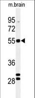 Polyclonal Rabbit anti-Human FA2H / FAAH Antibody (aa121-148, IHC, WB)