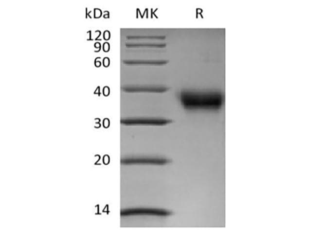 Human FOLR1 / Folate Receptor Alpha Protein (Recombinant AVI-6His, C-terminus)