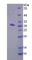 Human BPGM Protein (Recombinant)