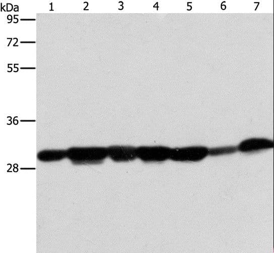 AK2 / Adenylate Kinase 2 Antibody