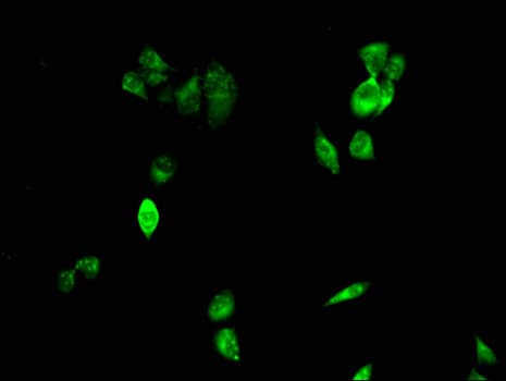 CIDEA / CIDE-A Antibody