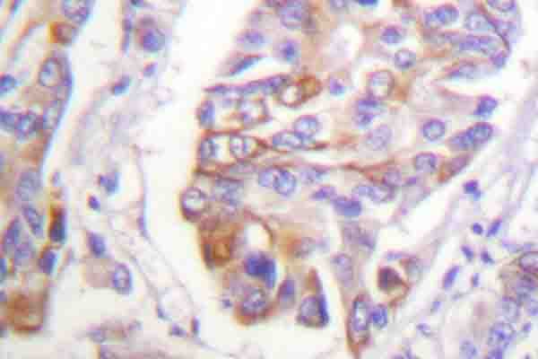 Polyclonal Rabbit anti-Human ADD1 / Adducin Alpha Antibody (phospho-Ser726, IHC, WB)