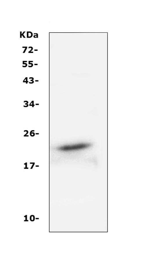 Polyclonal Rabbit anti-Human FGF21 Antibody (WB)