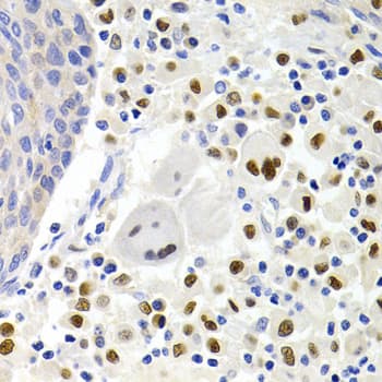 Polyclonal Rabbit anti-Human SIP1 Antibody (IHC, IF, WB)