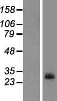 PPAPDC1A / DPPL2 Protein (Over-Expression Lysate Myc-DDK (Flag))