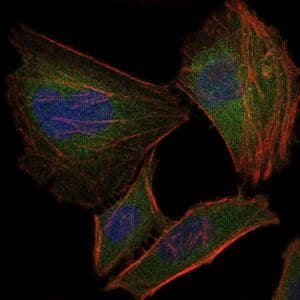 TNNI2 Antibody (clone 2F12G2)
