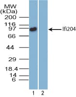Polyclonal Rabbit anti-Mouse Ifi204 Antibody (aa70-120, IHC, WB)