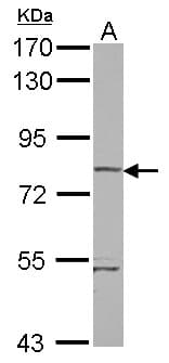 Polyclonal Rabbit anti-Human RHOBTB1 Antibody (WB)