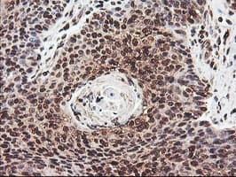 COPS5 / JAB1 Antibody (clone OTI2B12)