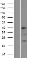MRPL32 Protein (Over-Expression Lysate Myc-DDK (Flag))