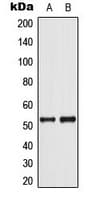 TP53 / p53 Antibody (phospho-Ser37)