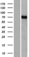 CCDC37 Protein (Over-Expression Lysate Myc-DDK (Flag))