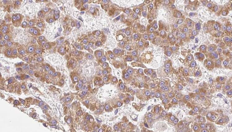 ABCC8 / SUR1 Antibody