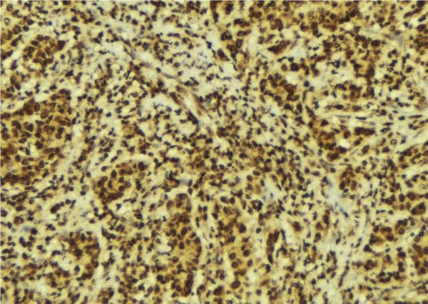 Polyclonal Rabbit anti-Human GTF2E2 Antibody (IHC, IF, WB)