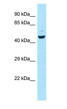 CCKAR / CCK1R Antibody (aa242-291)