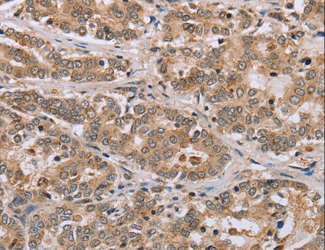 CLEC16A / KIAA0350 Antibody
