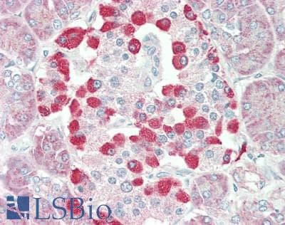 IHC-plus™ SIK3 / QSK Antibody (aa900-950)