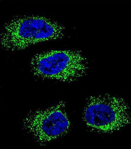 IHC-plus™ Polyclonal Rabbit anti-Human HSP90B1 / GP96 / GRP94 Antibody (aa16-43, IHC, IF, WB)