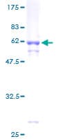 Human MLX / TCFL4 Protein (Recombinant GST)