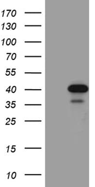 M-PST / STM Antibody (clone OTI6A8)