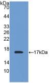 TTR / Transthyretin Antibody (aa21-147)