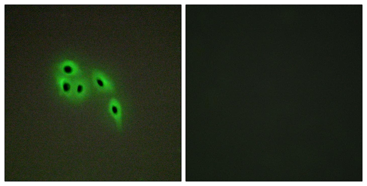 DOK6 Antibody