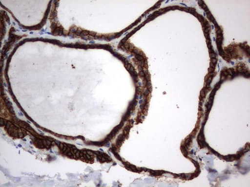 Monoclonal Mouse anti-Human CD44 Antibody (clone UMAB134, Carrier-free, IHC, IF, WB)