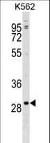 POLR3G Antibody (aa195-223)