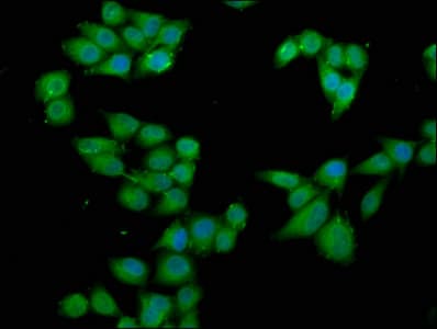 RPS6KA2 / RSK3 Antibody