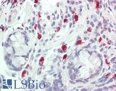 IHC-plus™ Polyclonal Rabbit anti-Human ERIC-1 / TACC3 Antibody (aa375-425, IHC, WB)