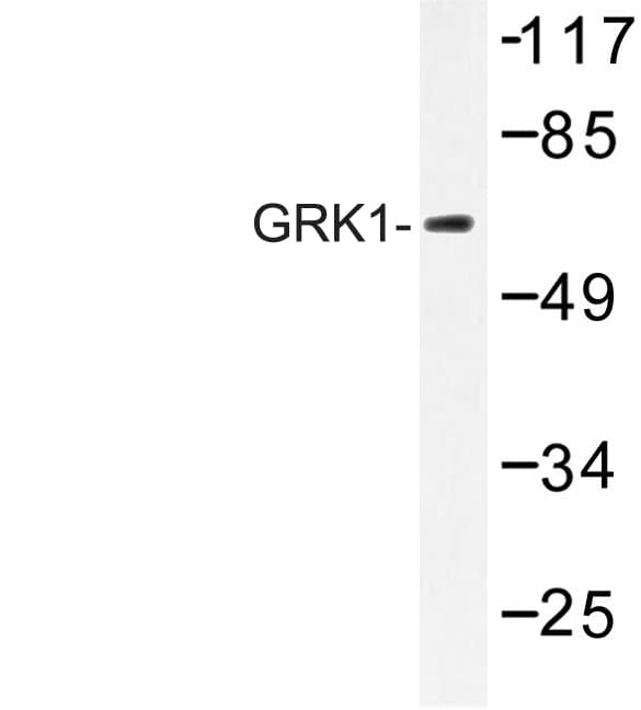 Rhodopsin Kinase / GRK1 Antibody (Ala17)