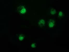 Monoclonal Mouse anti-Human NMNAT1 / NMNAT Antibody (clone OTI1F7, IF, WB)