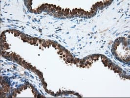 ACAT2 Antibody (clone OTI1B7)
