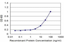 Monoclonal Mouse anti-Human TMPRSS2 / Epitheliasin Antibody (clone 2F4, WB)
