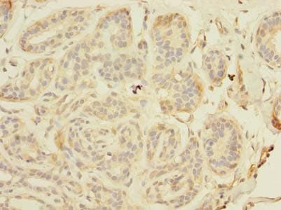 Polyclonal Rabbit anti-Human TAGAP Antibody (IHC)