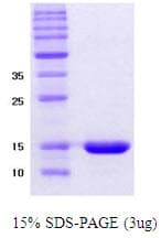 Human SNCA / Alpha-Synuclein Protein (Recombinant)