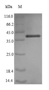 Human IL7 Protein (Recombinant 6His-SUMO, N-terminus)