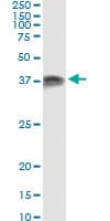 IHC-plus™ Monoclonal Mouse anti-Human PRKRA / PACT Antibody (clone 1B9-1A7, IHC, WB)