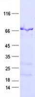 Human SEMG2 Protein (Recombinant His, N-Terminal)