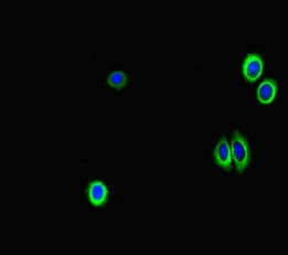 GAA / Alpha-Glucosidase, Acid Antibody (aa601-952)