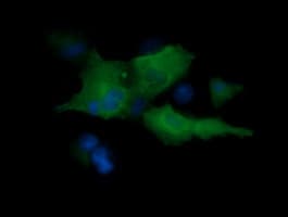 MAP2K1 / MKK1 / MEK1 Antibody (clone OTI1B4, Carrier-free)
