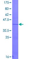 Human Proteoglycan 4 / Lubricin Protein (Recombinant GST, N-terminus)