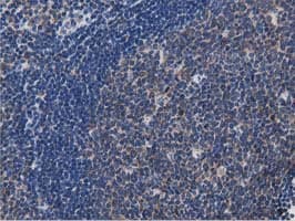 Monoclonal Mouse anti-Human MYD88 Antibody (clone OTI2B2, IHC, IF, WB)