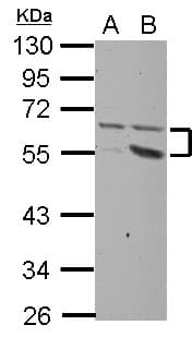 Polyclonal Rabbit anti-Human PLXDC2 Antibody (WB)