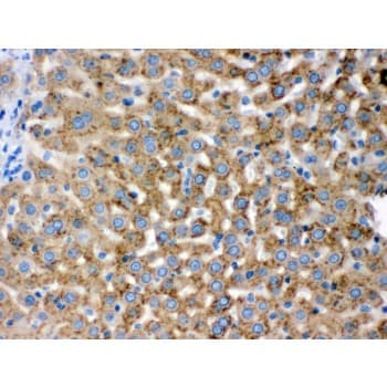 Polyclonal Rabbit anti-Human PGRMC1 / MPR Antibody (aa67-102, IHC, WB)